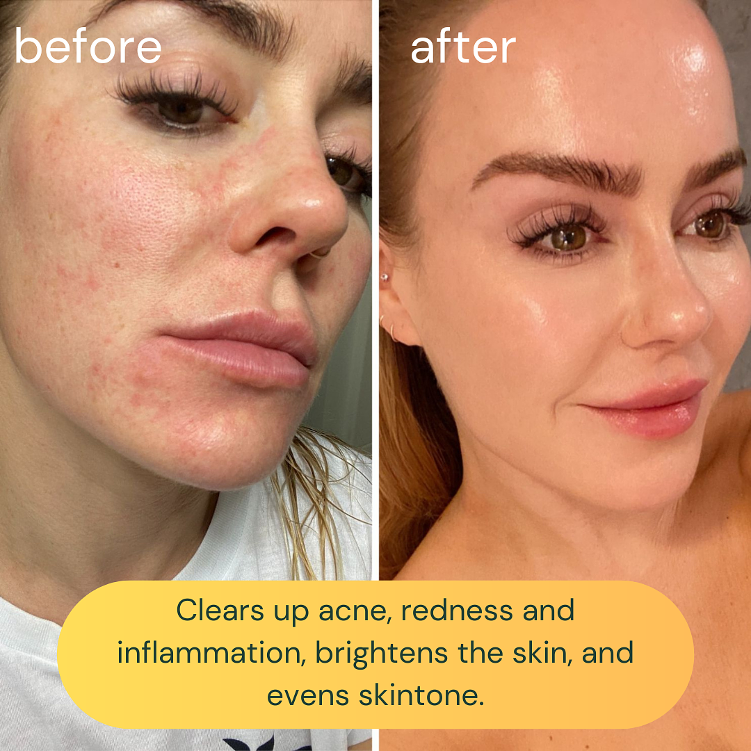Koa Life Vit-C Brightening Cleanser | 50 ml