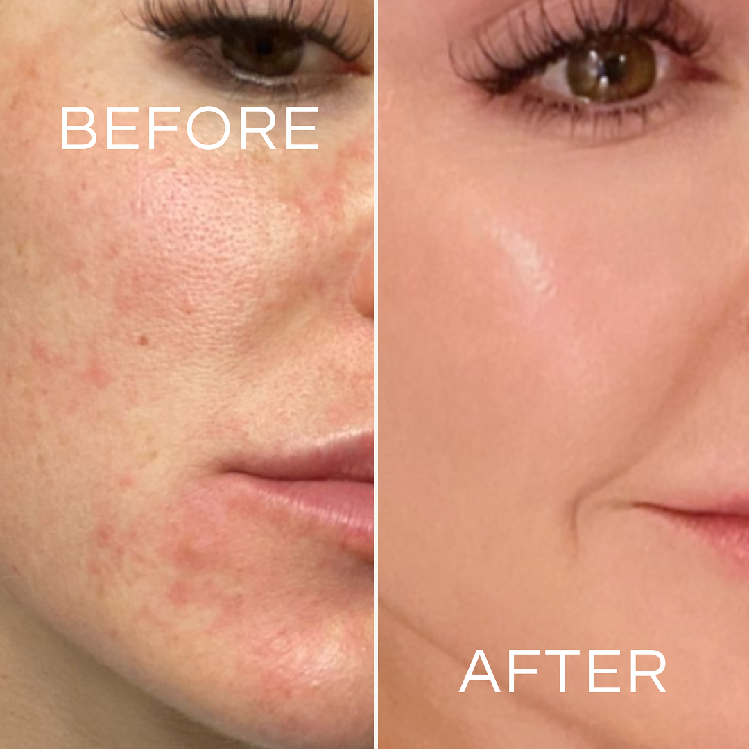 Koa Life Vit-C Brightening Cleanser | 50 ml