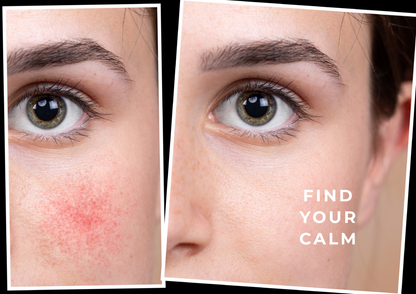 CV Skinlabs Calming Moisture for Face, Neck and Scalp