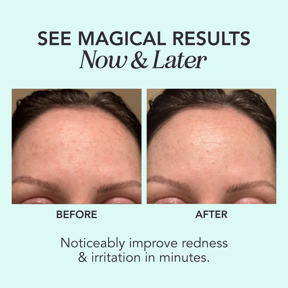 Herbivore Botanicals Green Magic Cica + Ceramides Redness-Reducing Serum