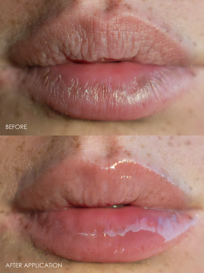 Reflekt Restorative Lip Balm