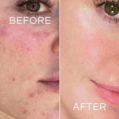 Koa Life Vit-C Brightening Cleanser | 50 ml