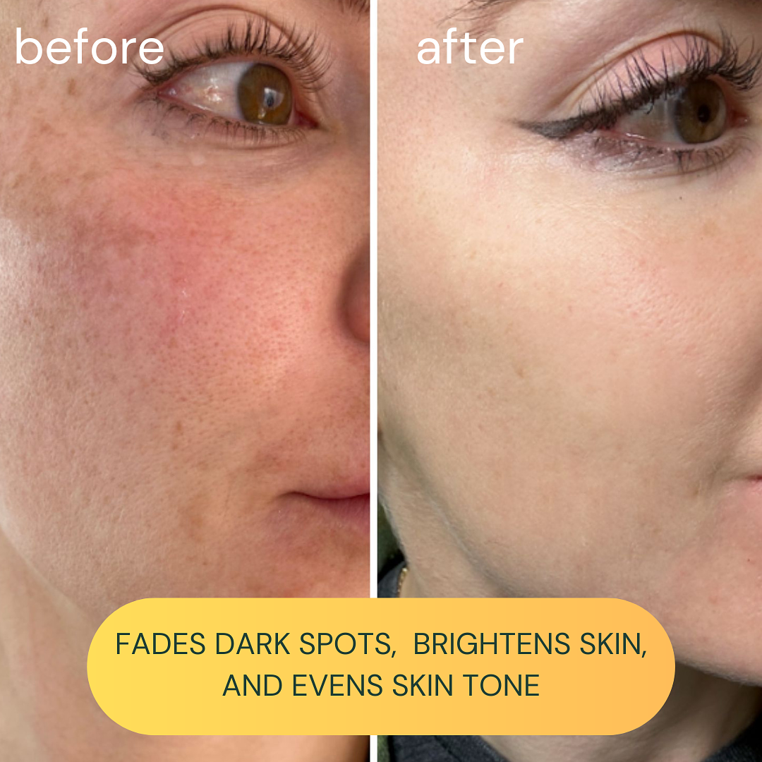 Koa Life Vit-C Brightening Oil