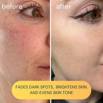Koa Life Vit-C Brightening Oil
