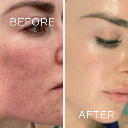 Koa Life Vit-C Brightening Cleanser | 50 ml